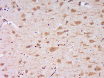 DENND4B Rabbit Polyclonal Antibody