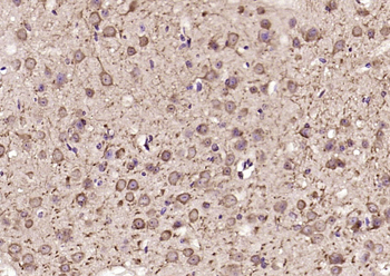 DENND5A Rabbit Polyclonal Antibody