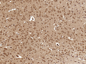 DHX30 Rabbit Polyclonal Antibody