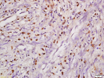 DHX8 Rabbit Polyclonal Antibody