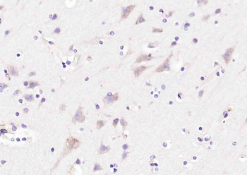 DNAH1 Rabbit Polyclonal Antibody
