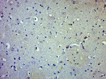 DNAH1 Rabbit Polyclonal Antibody