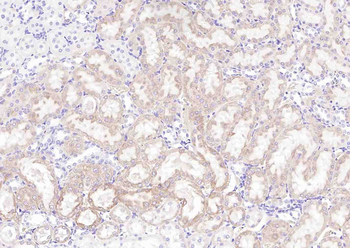DNAH1 Rabbit Polyclonal Antibody