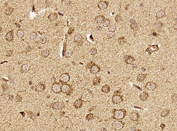 DNAH1 Rabbit Polyclonal Antibody