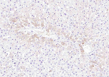 DNAH1 Rabbit Polyclonal Antibody