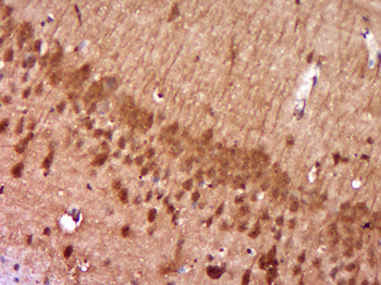 DNAJB5 Rabbit Polyclonal Antibody