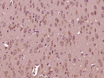 DNAJC19 Rabbit Polyclonal Antibody