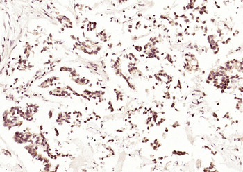 DNAJC2 Rabbit Polyclonal Antibody