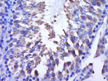 DNAJC5G Rabbit Polyclonal Antibody