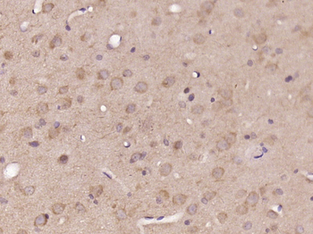 DNASE1L2 Rabbit Polyclonal Antibody