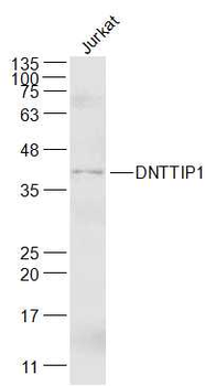 DNTTIP1 Rabbit Polyclonal Antibody
