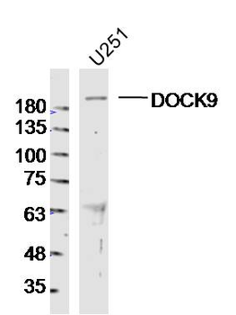 DOCK9 Rabbit Polyclonal Antibody