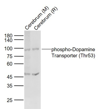 Phospho-Dopamine Transporter (Thr53) Rabbit Polyclonal Antibody