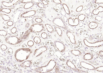 DPAGT1 Rabbit Polyclonal Antibody