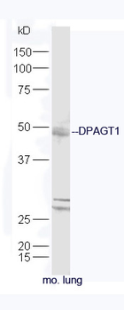 DPAGT1 Rabbit Polyclonal Antibody