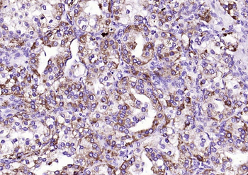 DTX3L Rabbit Polyclonal Antibody