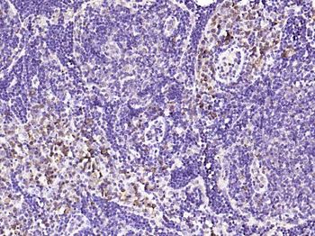 DTX3L Rabbit Polyclonal Antibody