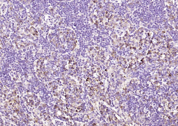 DTX3L Rabbit Polyclonal Antibody