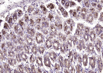 DTX3L Rabbit Polyclonal Antibody
