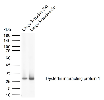 Dysferlin interacting protein 1 Rabbit Polyclonal Antibody