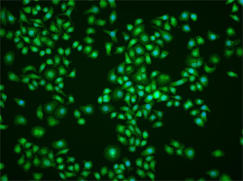 DRAK2 Rabbit Polyclonal Antibody