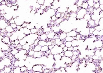 DRAK2 Rabbit Polyclonal Antibody