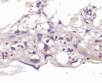 DRAK2 Rabbit Polyclonal Antibody