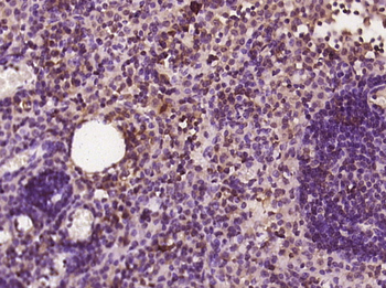 DNA Polymerase delta, catalytic subunit Rabbit Polyclonal Antibody