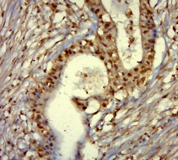 Phospho-ETS2 (Thr72) Rabbit Polyclonal Antibody