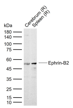 Ephrin-B2 Rabbit Polyclonal Antibody