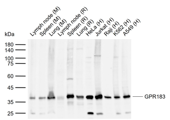 GPR183 Rabbit Polyclonal Antibody