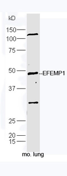 EFEMP1 Rabbit Polyclonal Antibody
