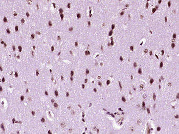 EHD3 Rabbit Polyclonal Antibody