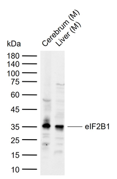 EIF2B1 Rabbit Polyclonal Antibody