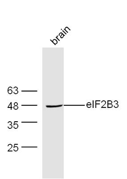 EIF2B3 Rabbit Polyclonal Antibody