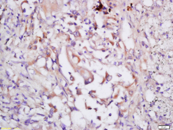 EIF3S2 Rabbit Polyclonal Antibody