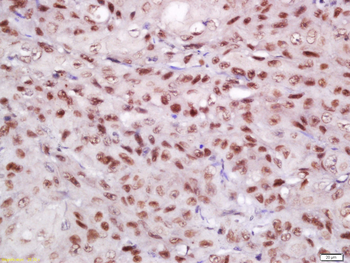 EIF3S4 Rabbit Polyclonal Antibody