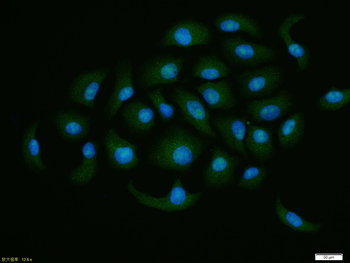 EIF4A3 Rabbit Polyclonal Antibody