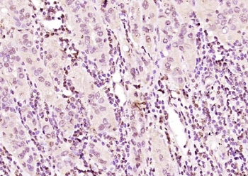 EIF4A3 Rabbit Polyclonal Antibody