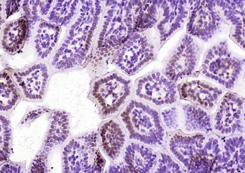 EIF4A3 Rabbit Polyclonal Antibody