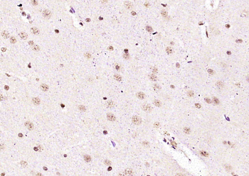 EIF4A3 Rabbit Polyclonal Antibody