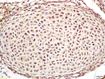 EIF4E2 Rabbit Polyclonal Antibody