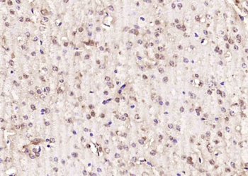 EIF4ENIF1 Rabbit Polyclonal Antibody