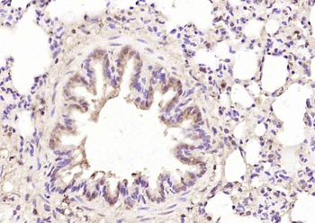 EIF4ENIF1 Rabbit Polyclonal Antibody