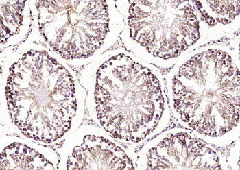 EIF4ENIF1 Rabbit Polyclonal Antibody