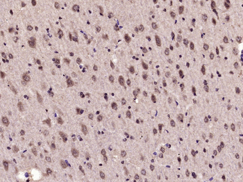 Phospho-eIF4EBP1 (Thr70) Rabbit Polyclonal Antibody