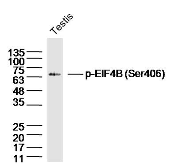 Phospho-EIF4B (Ser406) Rabbit Polyclonal Antibody