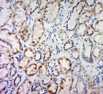 Elastase-2B Rabbit Polyclonal Antibody