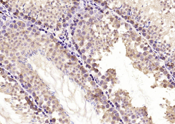 ELP4 Rabbit Polyclonal Antibody