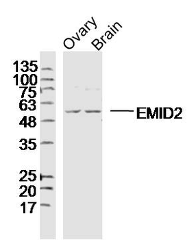 EMID2 Rabbit Polyclonal Antibody